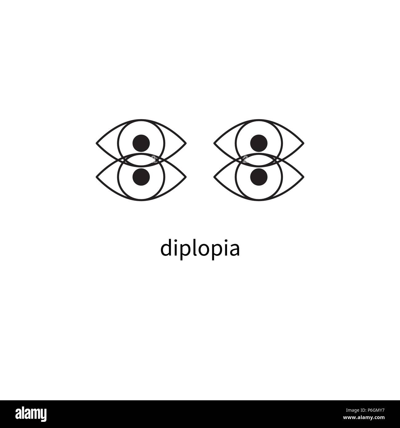 Diplopia sign, double vision, icon diplopia, dizziness Stock vector Stock Vector