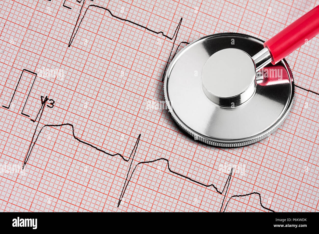 Phonendoscope lying on a cardiogram Stock Photo