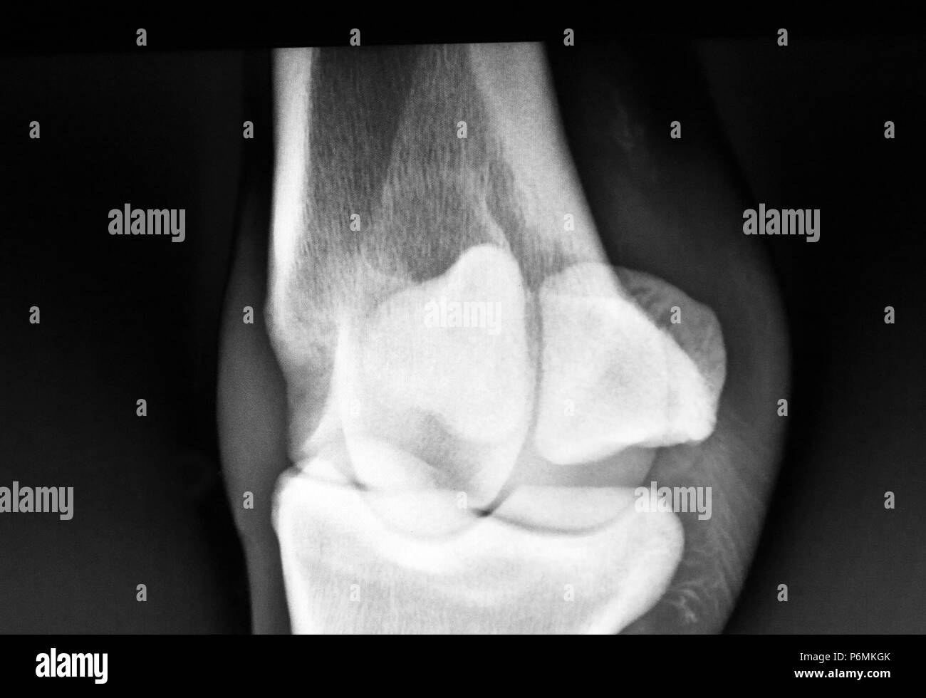 Melbeck, Roentgen picture of a fetlock joint and the same legs Stock Photo