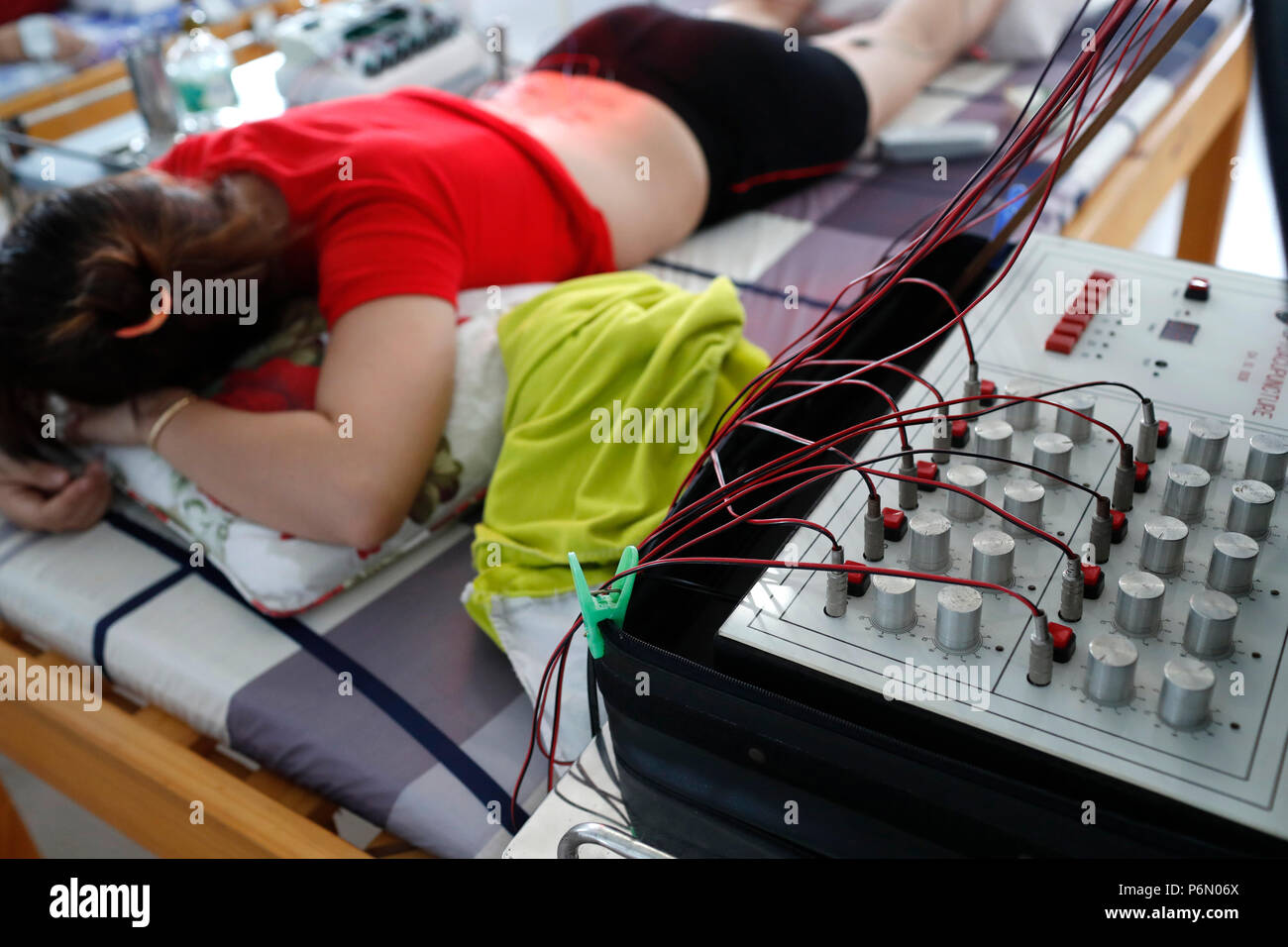 Vietnamese traditional medicine clinic. Acupuncture. Cu Chi. Vietnam