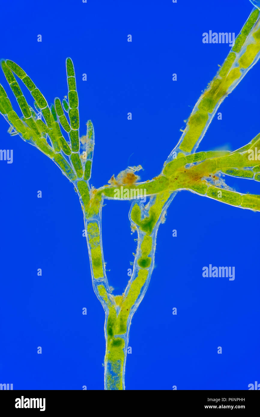 Microscopic view of green algae (Cladophora) branch. Rheinberg illumination. Stock Photo
