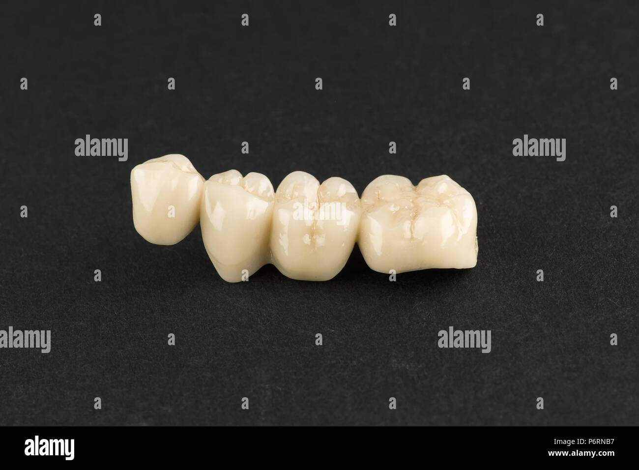 artificial dental structures made of ceramics for restoration of