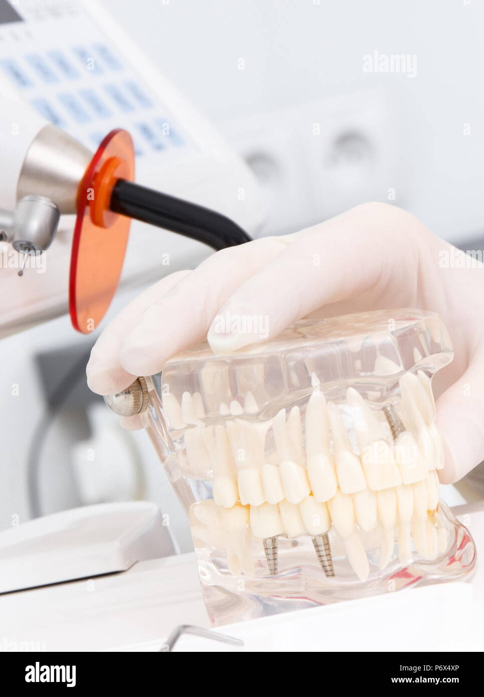 Dental jaw model hires stock photography and images Alamy