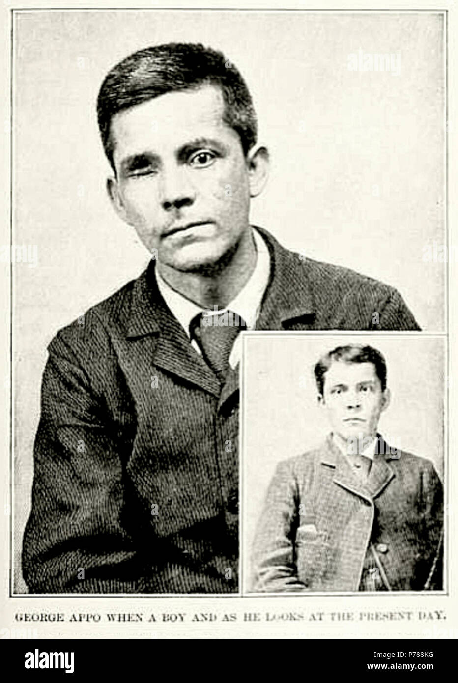 George Appo (1858-1930), New York criminal and son of the 'Chinese Devilman' Quimbo Appo . circa 1894 34 George Appo c1894 Stock Photo
