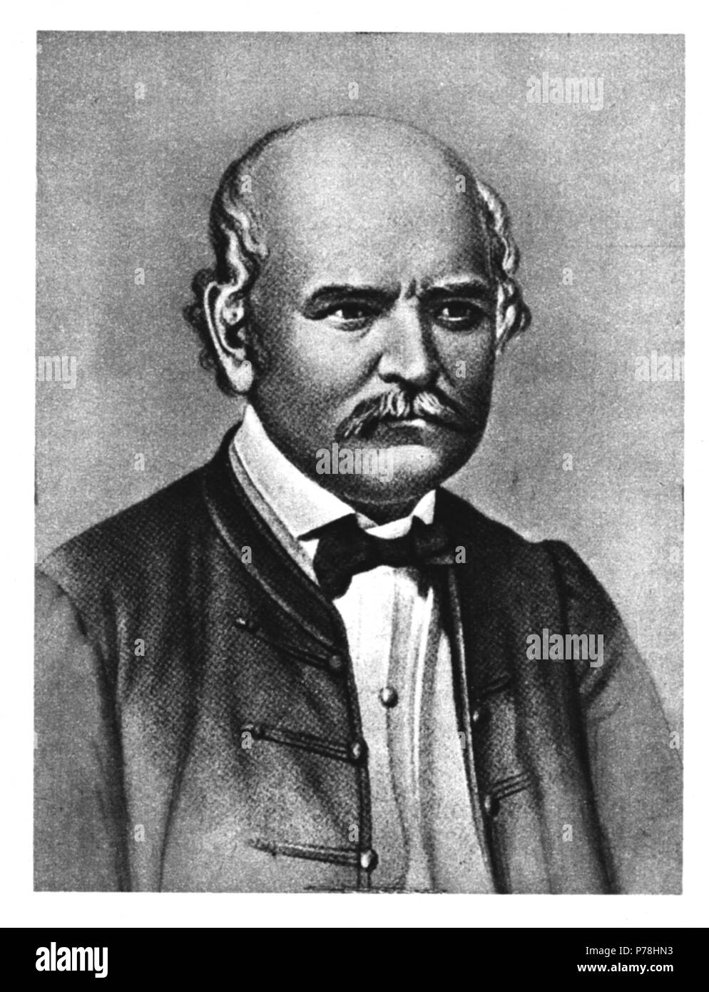 Ignaz philipp semmelweis Cut Out Stock Images & Pictures - Alamy