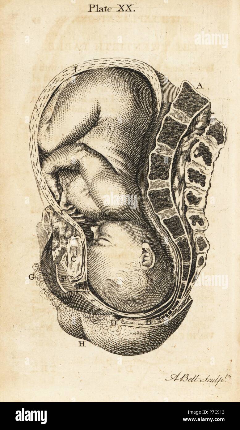 Foetus head in the contrary position in the birth canal during labour. Copperplate engraving by Andrew Bell after an illustration by Jan van Rymsdyk from William Smellie's A Set of Anatomical Tables, Charles Elliot, Edinburgh, 1780. Stock Photo