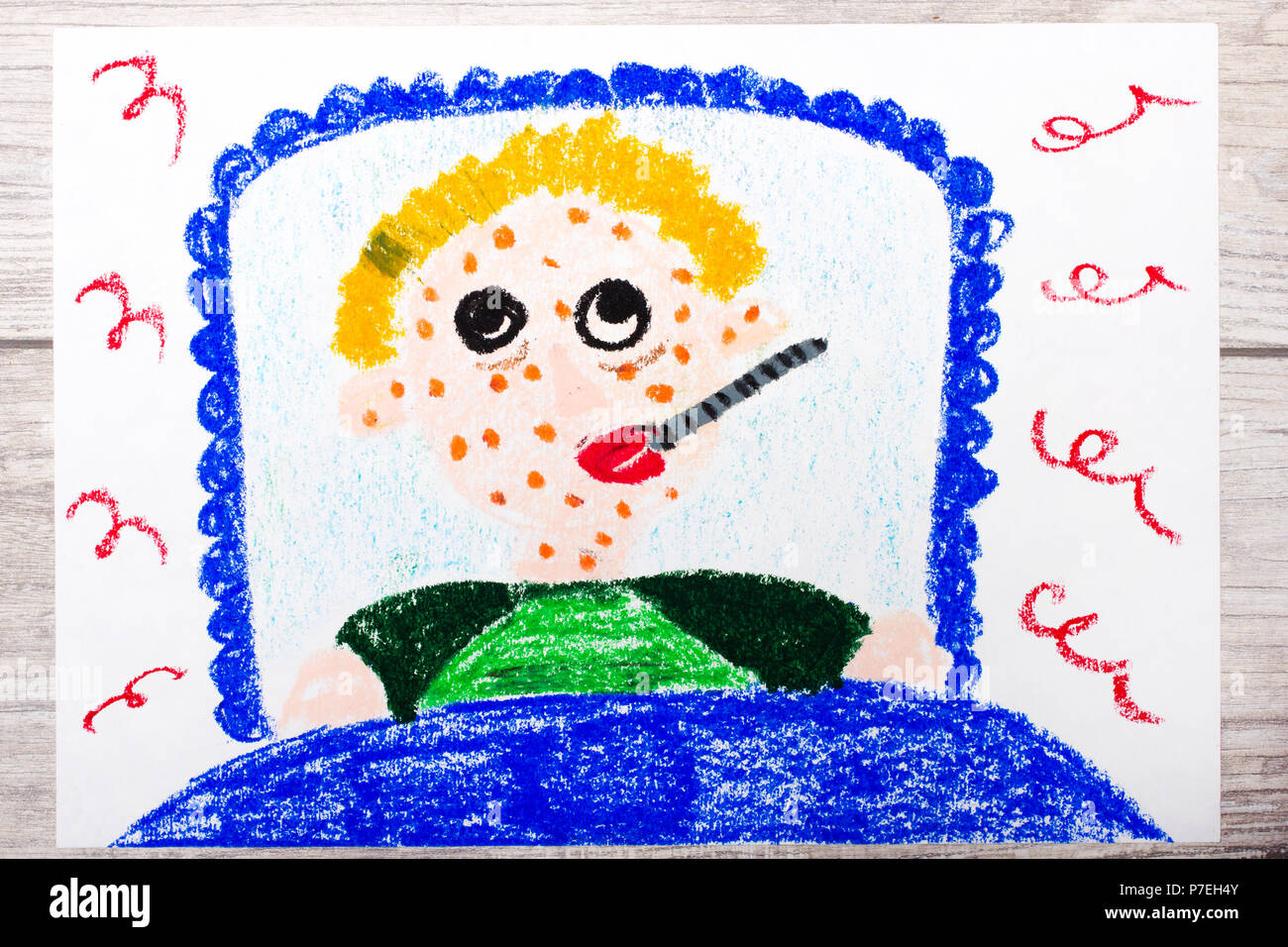Child Rash In Face High Resolution Stock Photography and Images - Alamy
