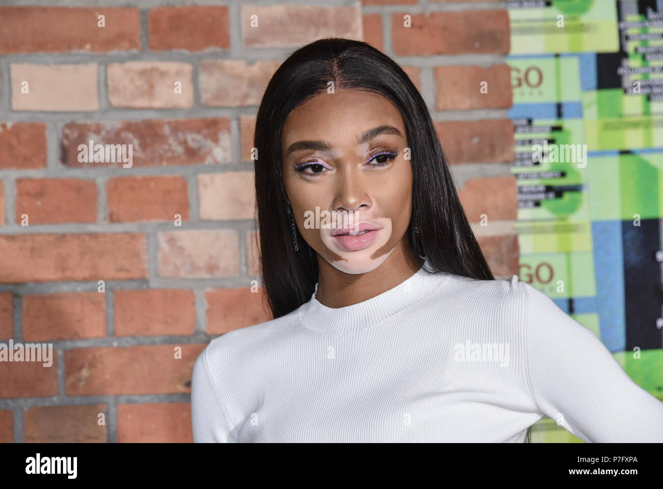 Winnie Harlow / HUGO Fashion Show Spring / Summer 2019 at Motorwerk