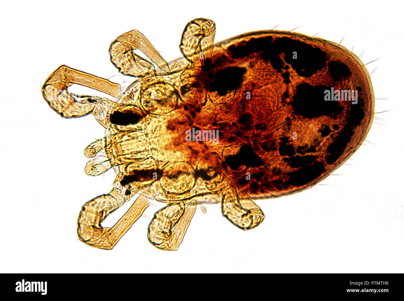 Microphoto of Red Mite (Dermanyssus gallinae) Stock Photo