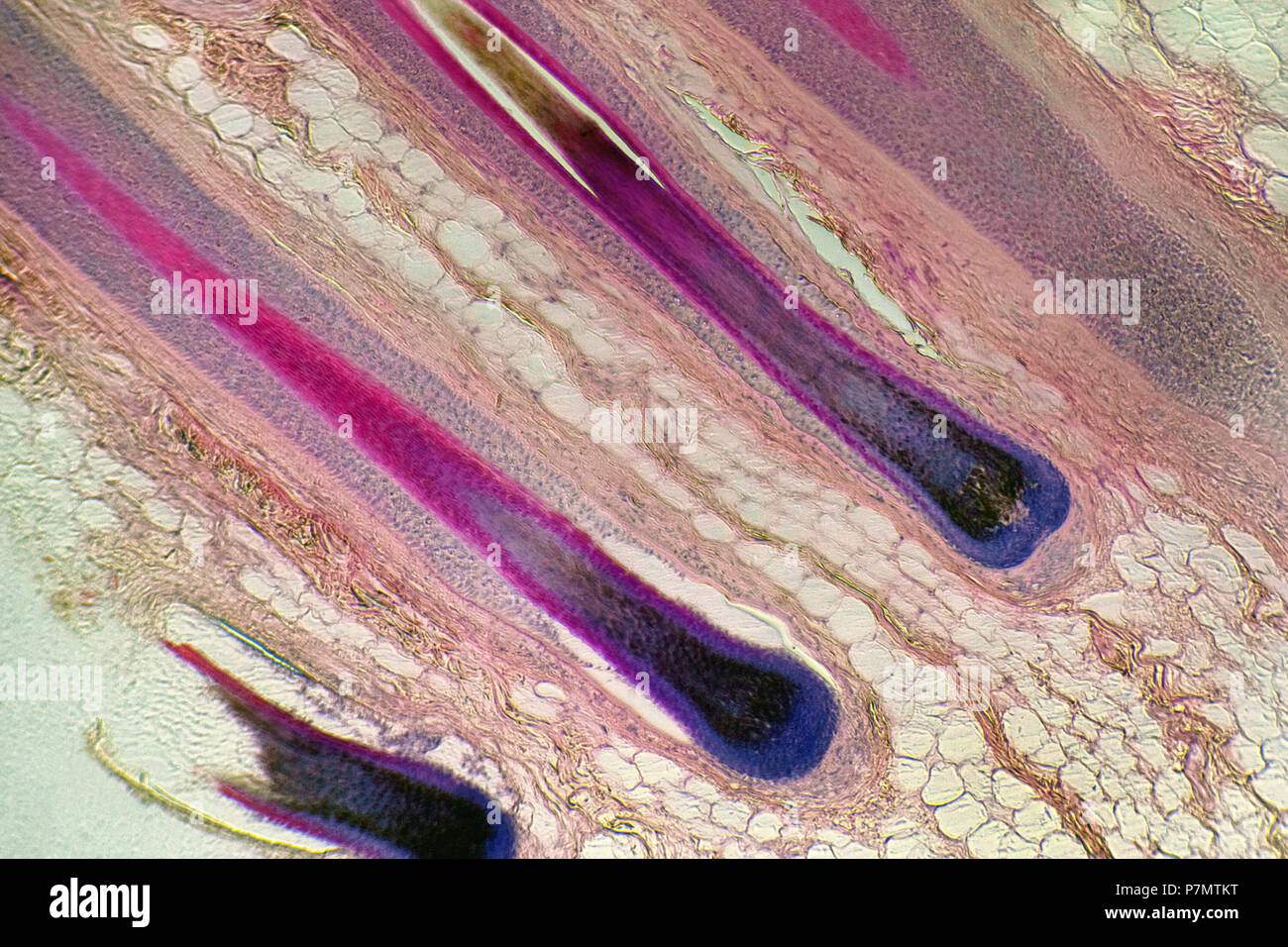Microphoto of hair folliculs of Modern Man (Homo sapiens sapiens) Stock Photo