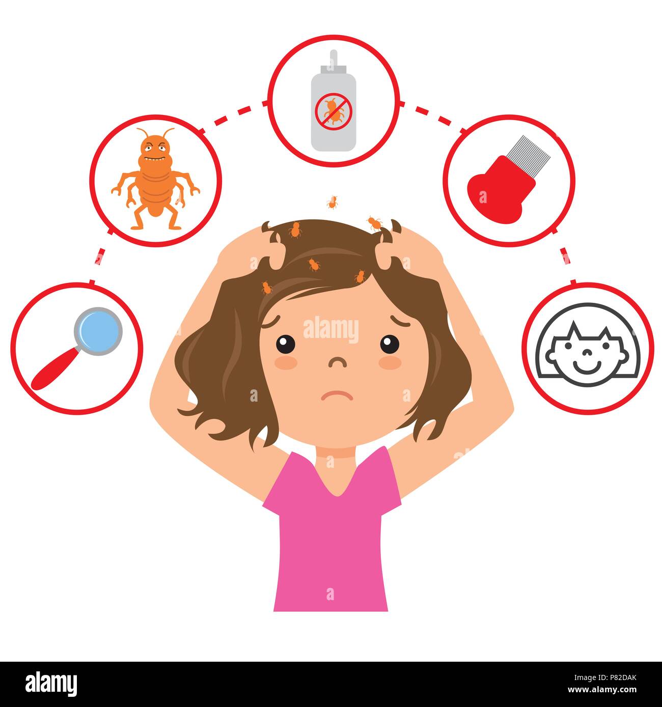 Girl with lice. step by step how to remove lice Stock Vector Image