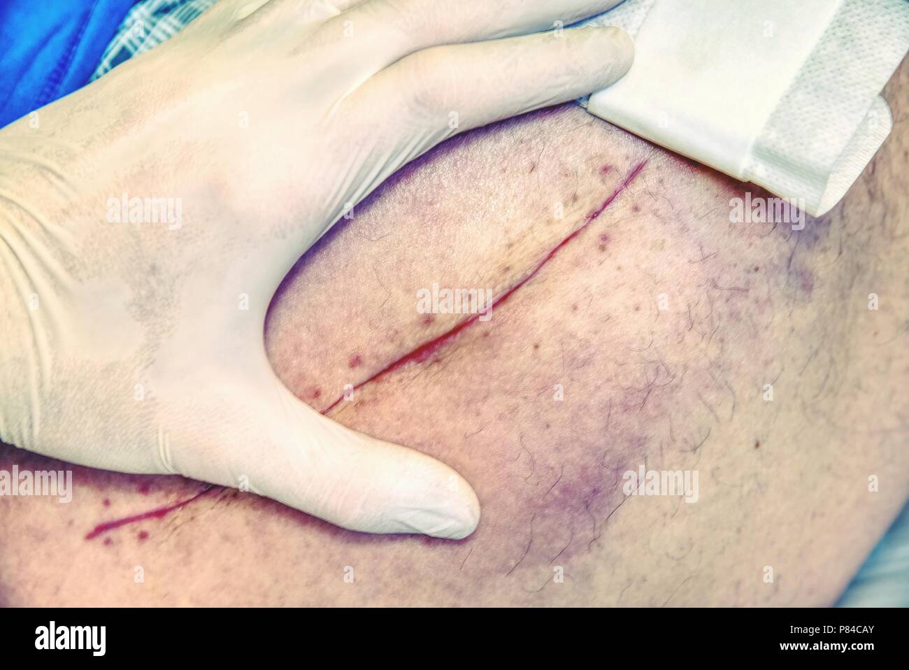 Cardiac Muscle Stock Photos & Cardiac Muscle Stock Images - Alamy