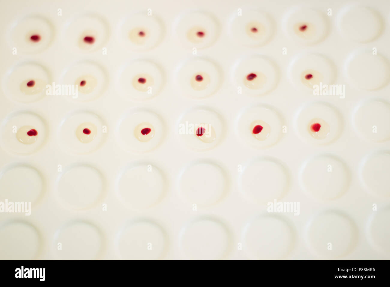Blood test.Drops of blood on a medical tablet Stock Photo Alamy