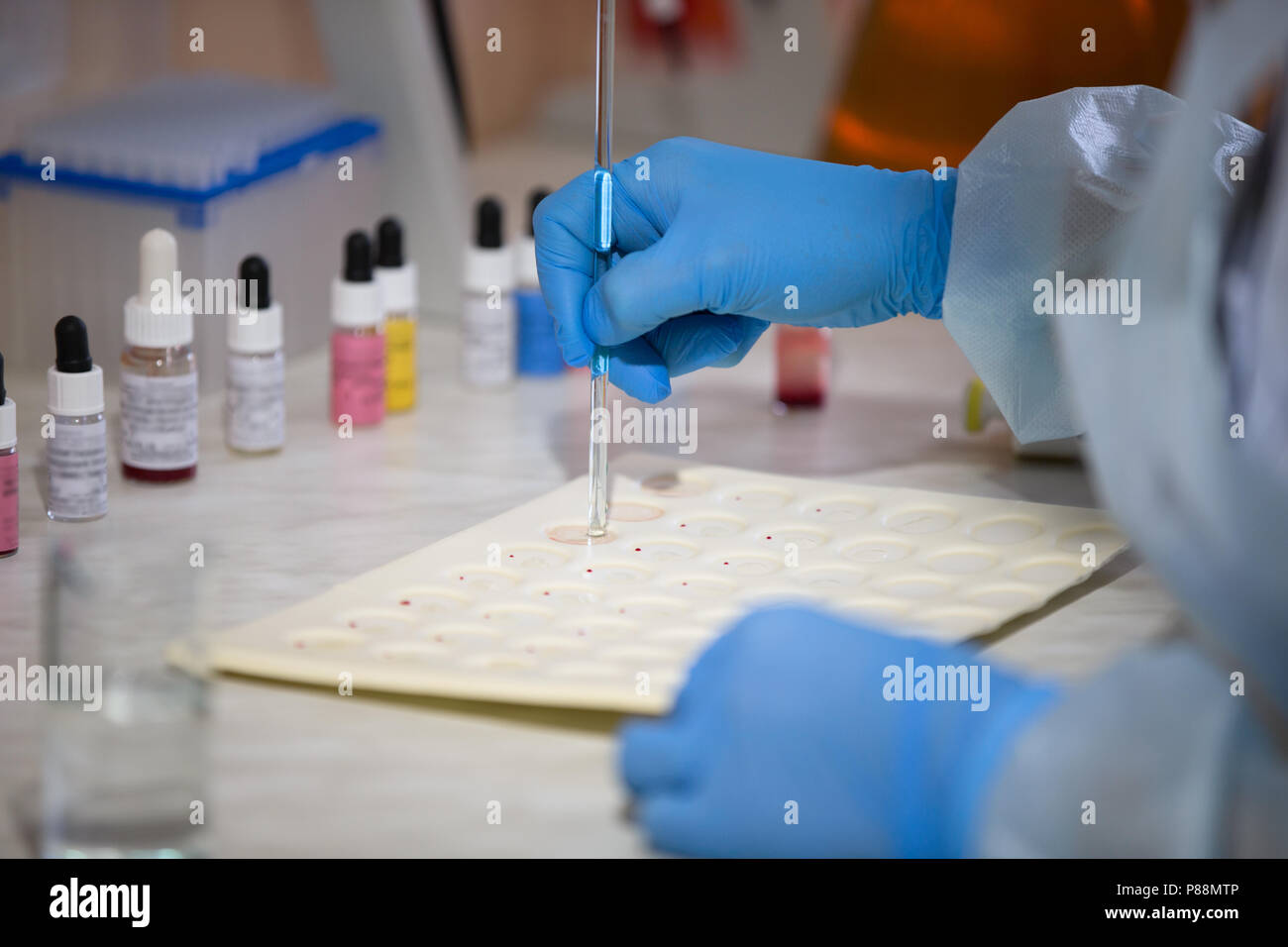 Blood test.Microbiological examination of blood Stock Photo Alamy