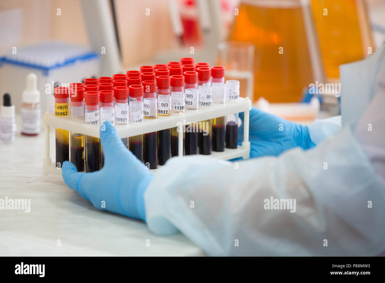 Blood test.Blood in test tubes Stock Photo Alamy