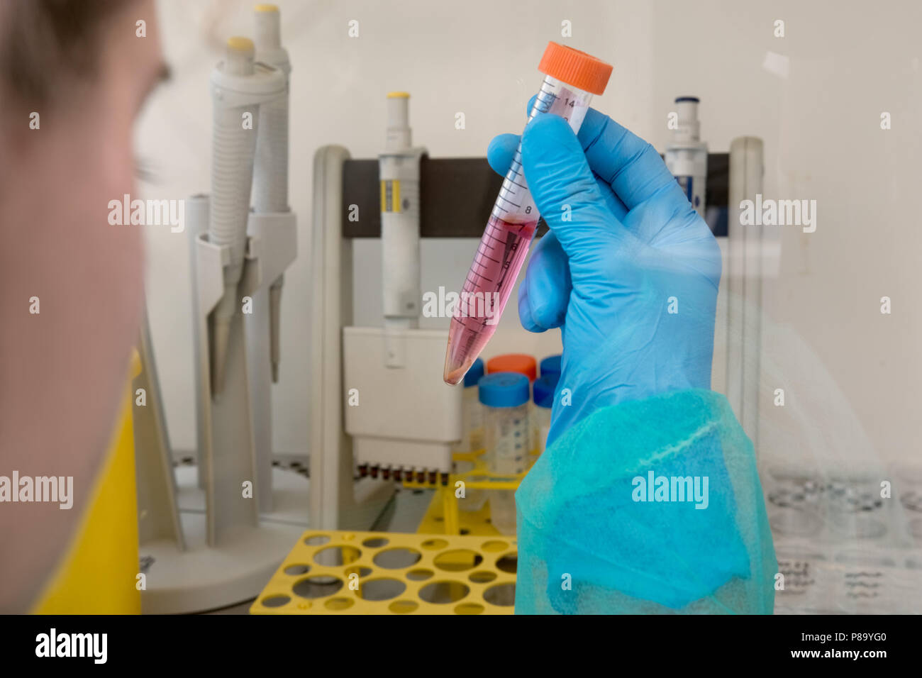 Medical samples prepared in the laboratory for cancer screening Stock Photo