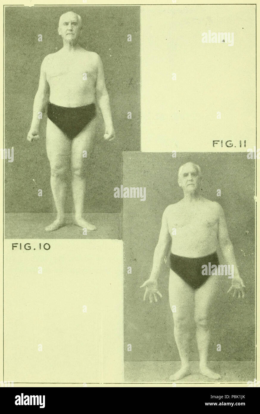 Tensing exercises hi-res stock photography and images - Alamy