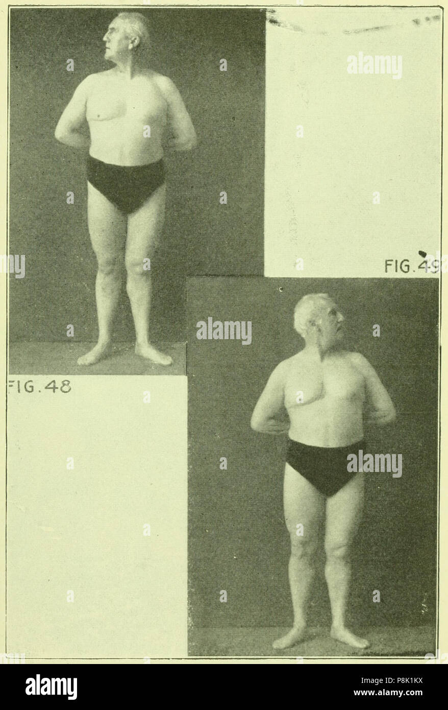 . 552 Tensing Exercises Fig48 Stock Photo - Alamy
