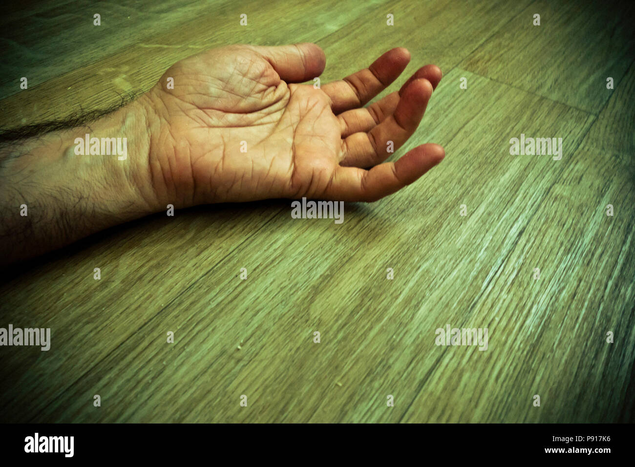 A Dead Right Arm at Megan Adams blog