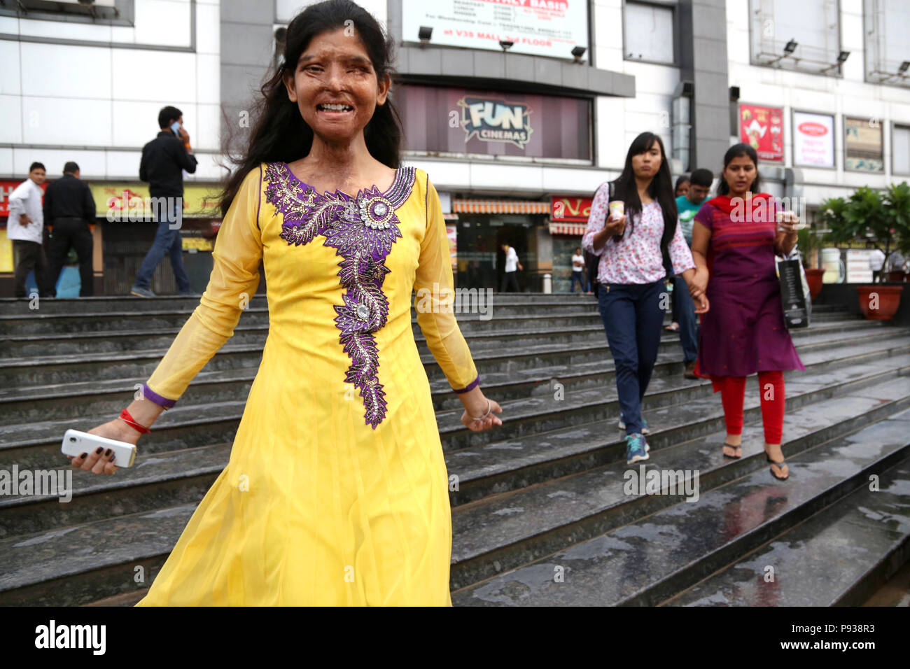 Ritu, victim of Acid attack, in a street in Delhi (from Stop Acid Attacks campaign, India) Stock Photo
