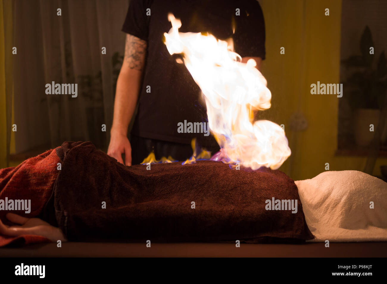 Chinese fire massage and therapy Stock Photo - Alamy