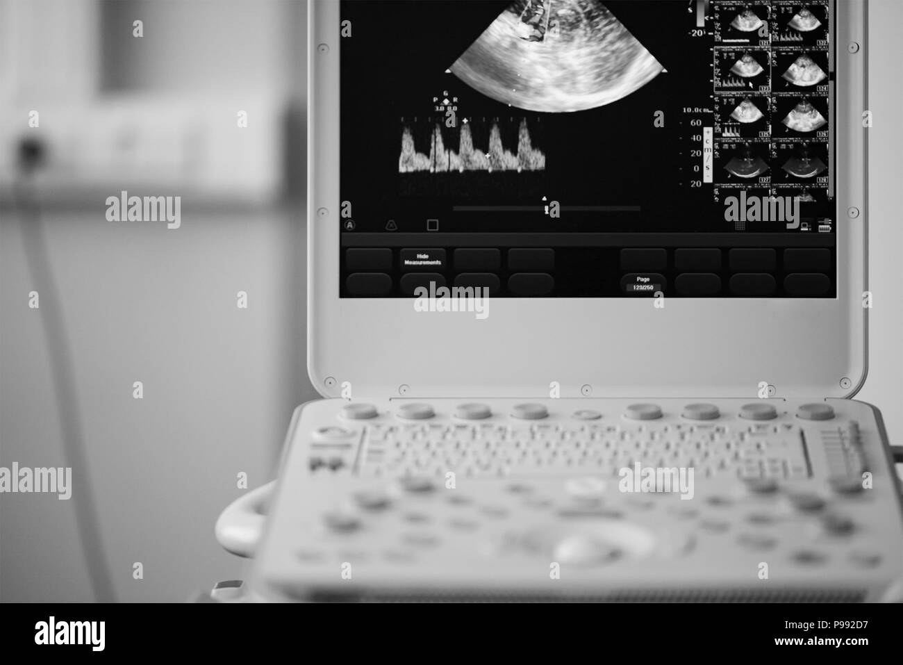 On the screen of an ultrasound machine, a saginal scan of the brain with visualization of the cerebral artery by the Doppler method and measurement of Stock Photo