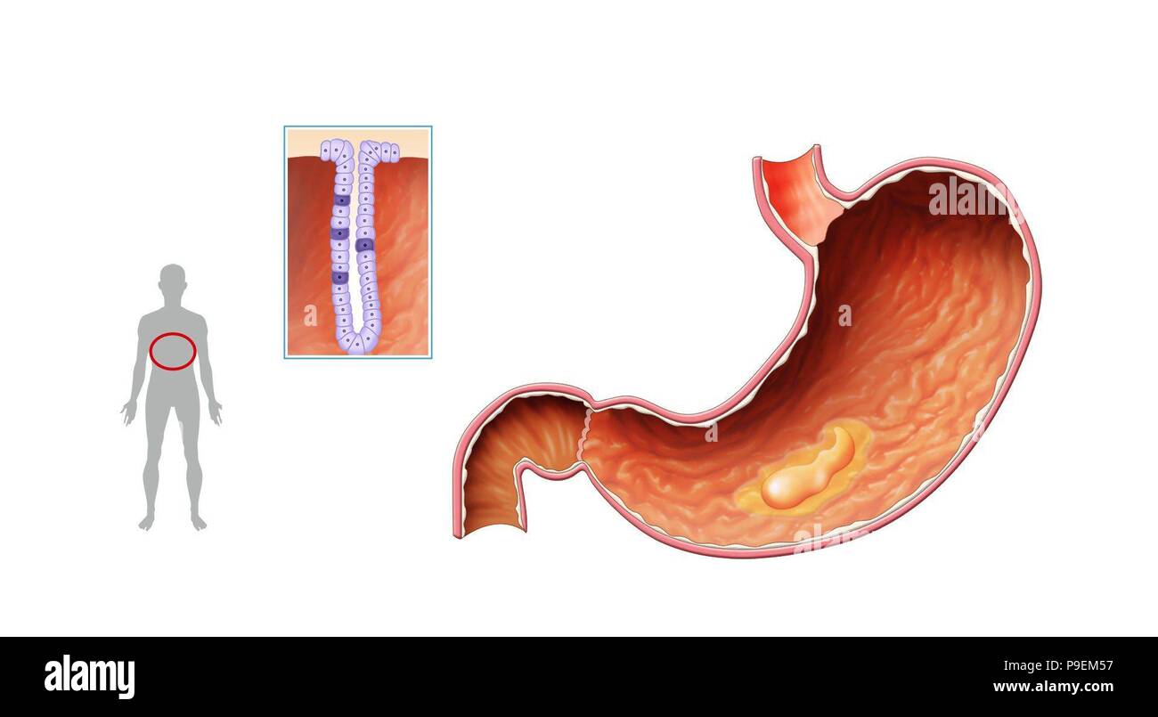 Chyme hires stock photography and images Alamy