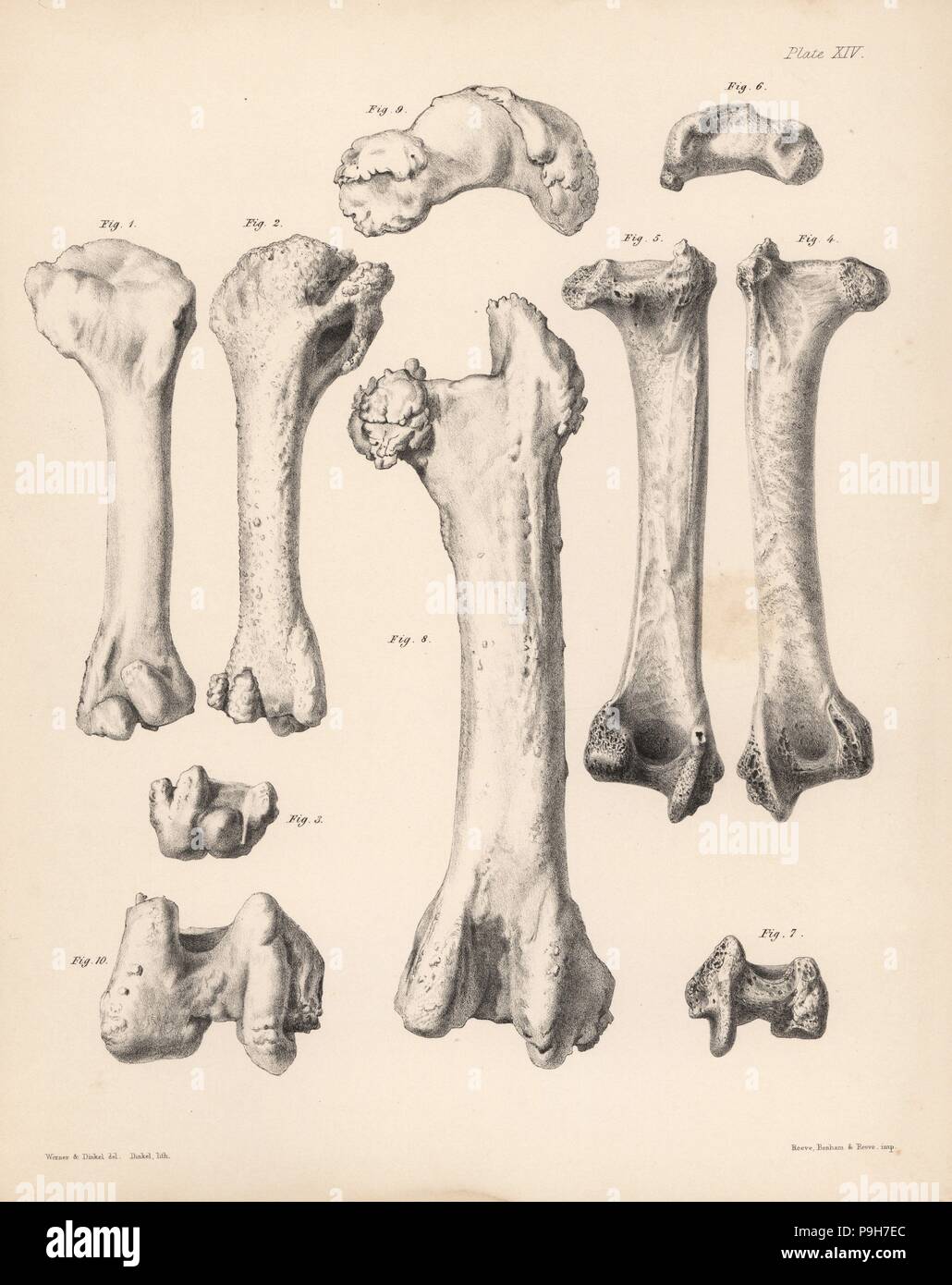 Humerus and femur of the extinct Rodrigues solitaire, Pezophaps solitaria, in the Parisian Collection and Andersonian Collection. Lithograph by Joseph Dinkel after Werner and Dinkel from Hugh Edwin Strickland and Alexander Gordon Melville's The Dodo and its Kindred, London, Reeve, Benham and Reeve, 1848. Stock Photo