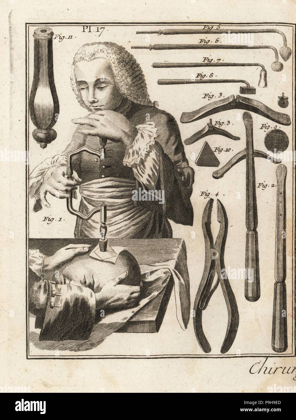 18th century surgeon performing a trepanning operation on a man's head,  with various surgical equipment: Jean Louis Petit's lever 2, trestle 3,  Valet's pincers 4, cauterizers 5-8, round plaque 9, triangular plaque