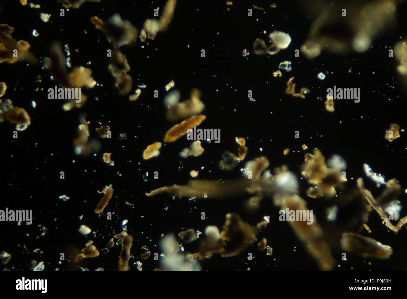 house dust in the microscope Stock Photo Alamy