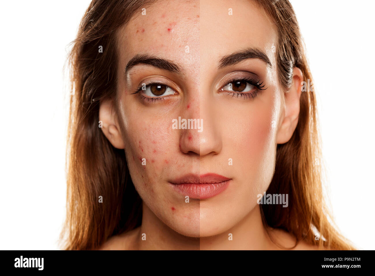 comparition portrait of same woman before and after cosmetic treatment amd makeup on white background Stock Photo