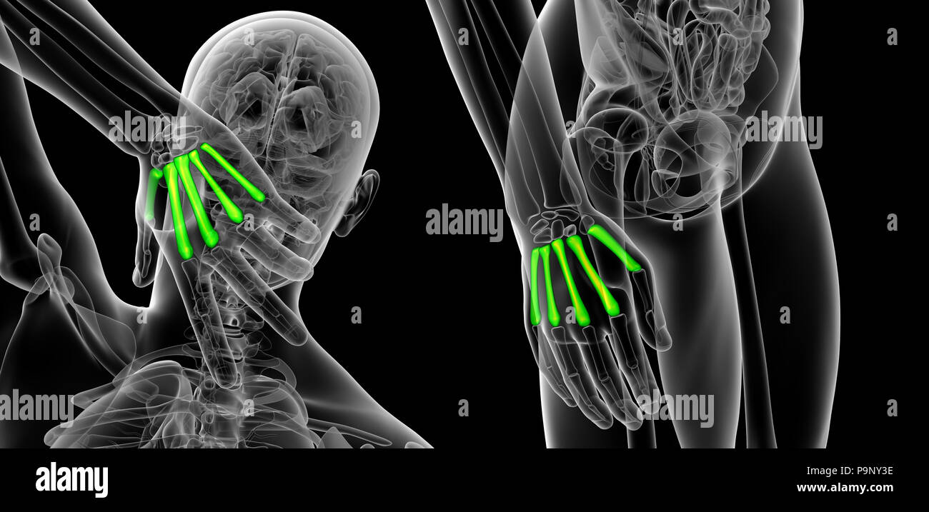 3d rendering illustration of metacarpal Stock Photo