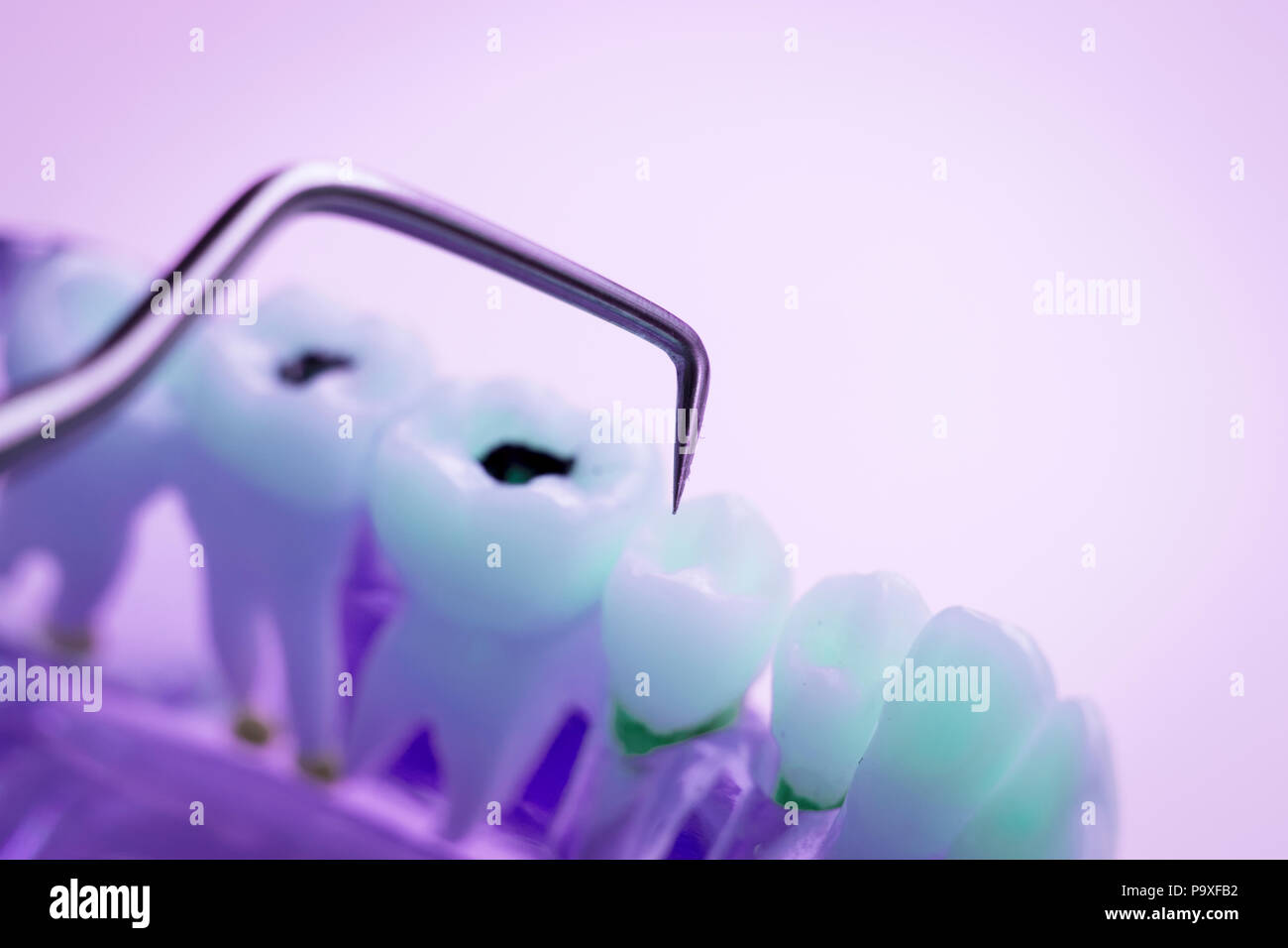 Dentist cleaning teeth with titanium metal tooth pick instrument to