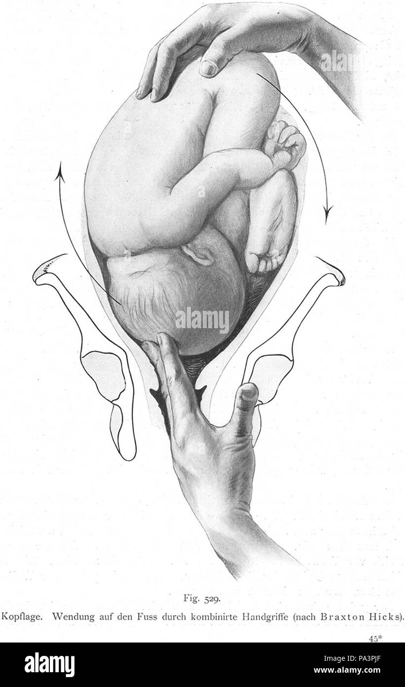 257 Bumm 529 lg Stock Photo