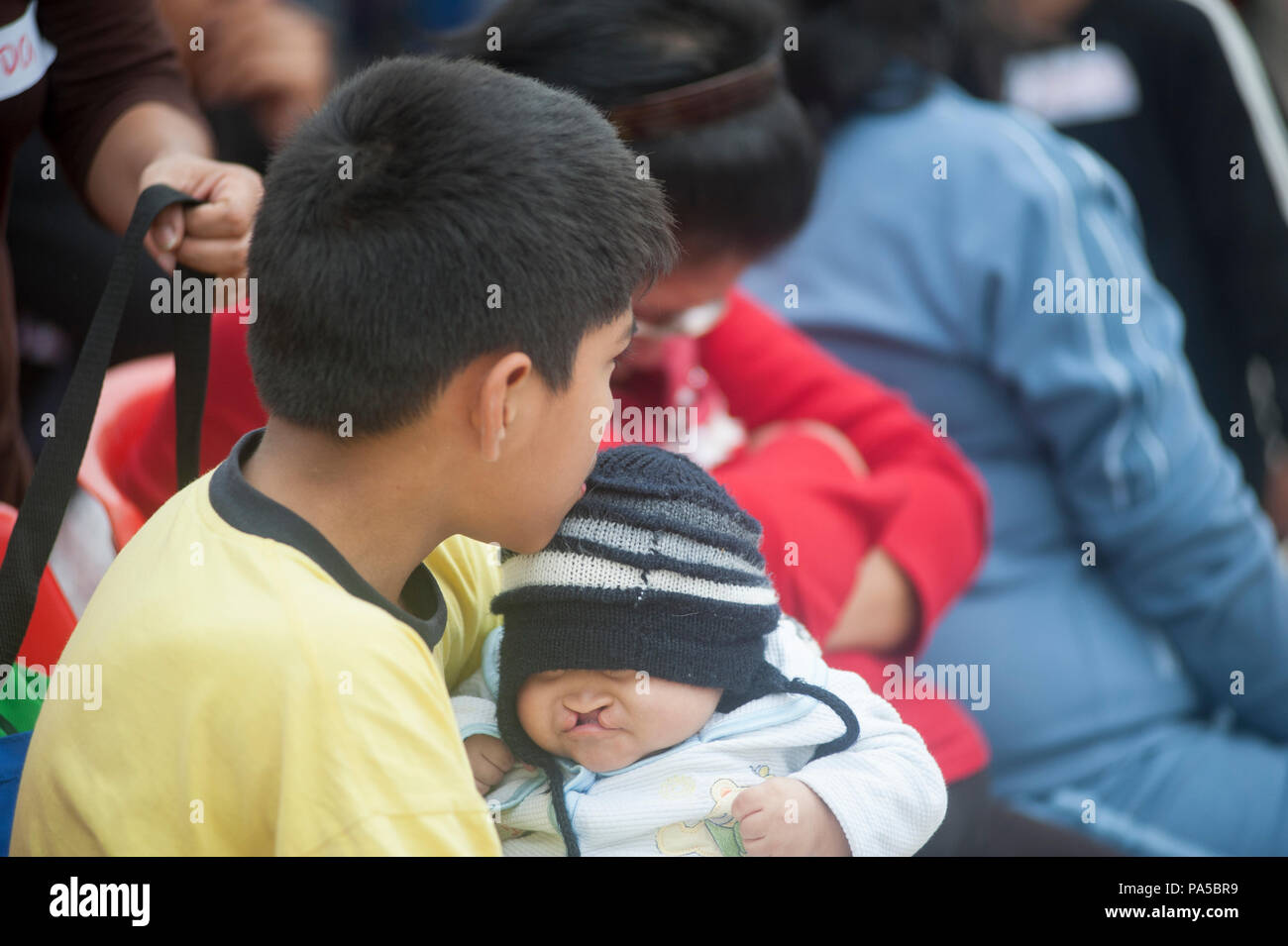 Family of cleft lip, brothers. Children with chullo waiting embraced. Stock Photo