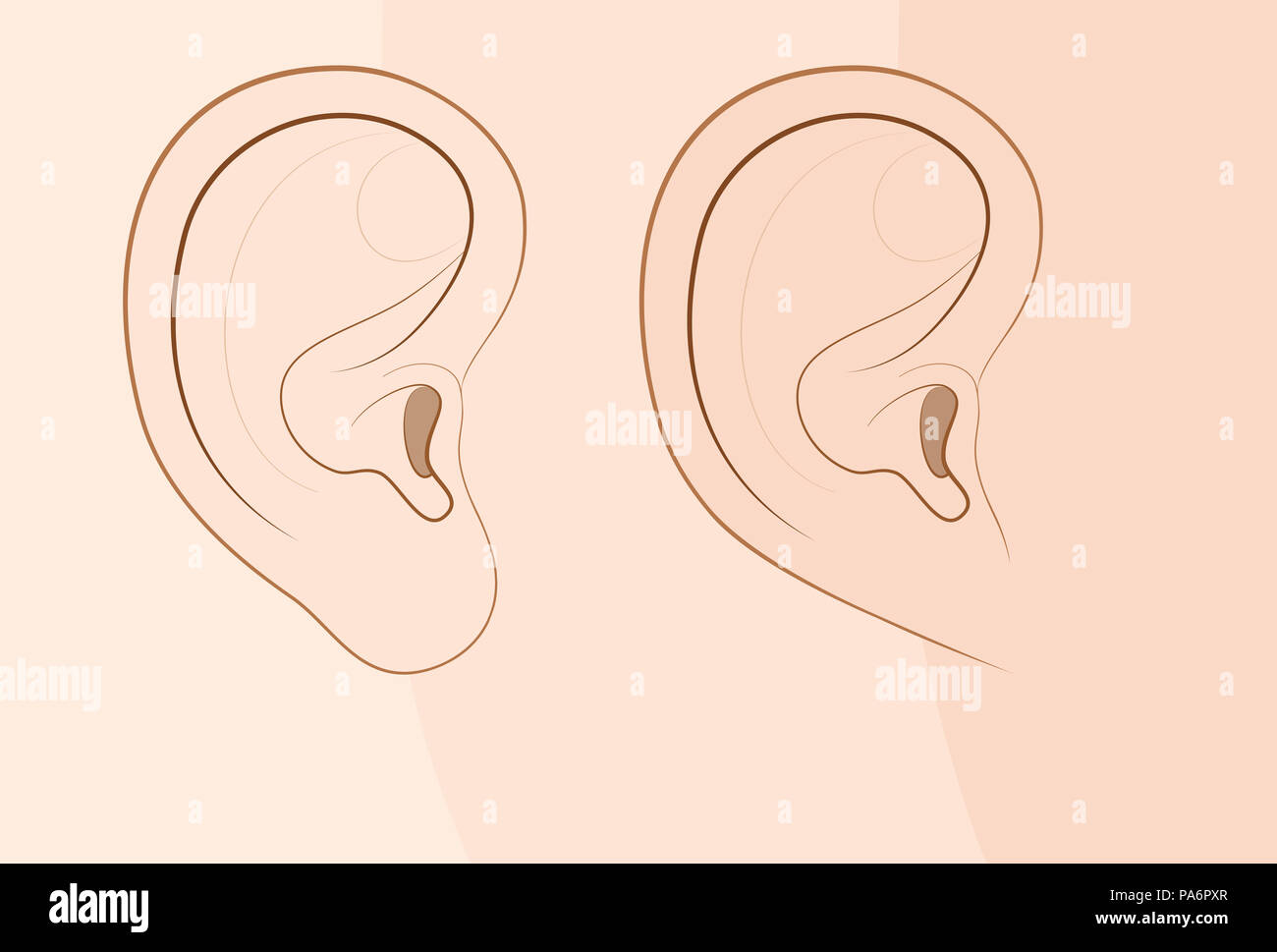Attached earlobe and free earlobe in comparison. Different looks of the human ear because of recessive gene frequency. Stock Photo