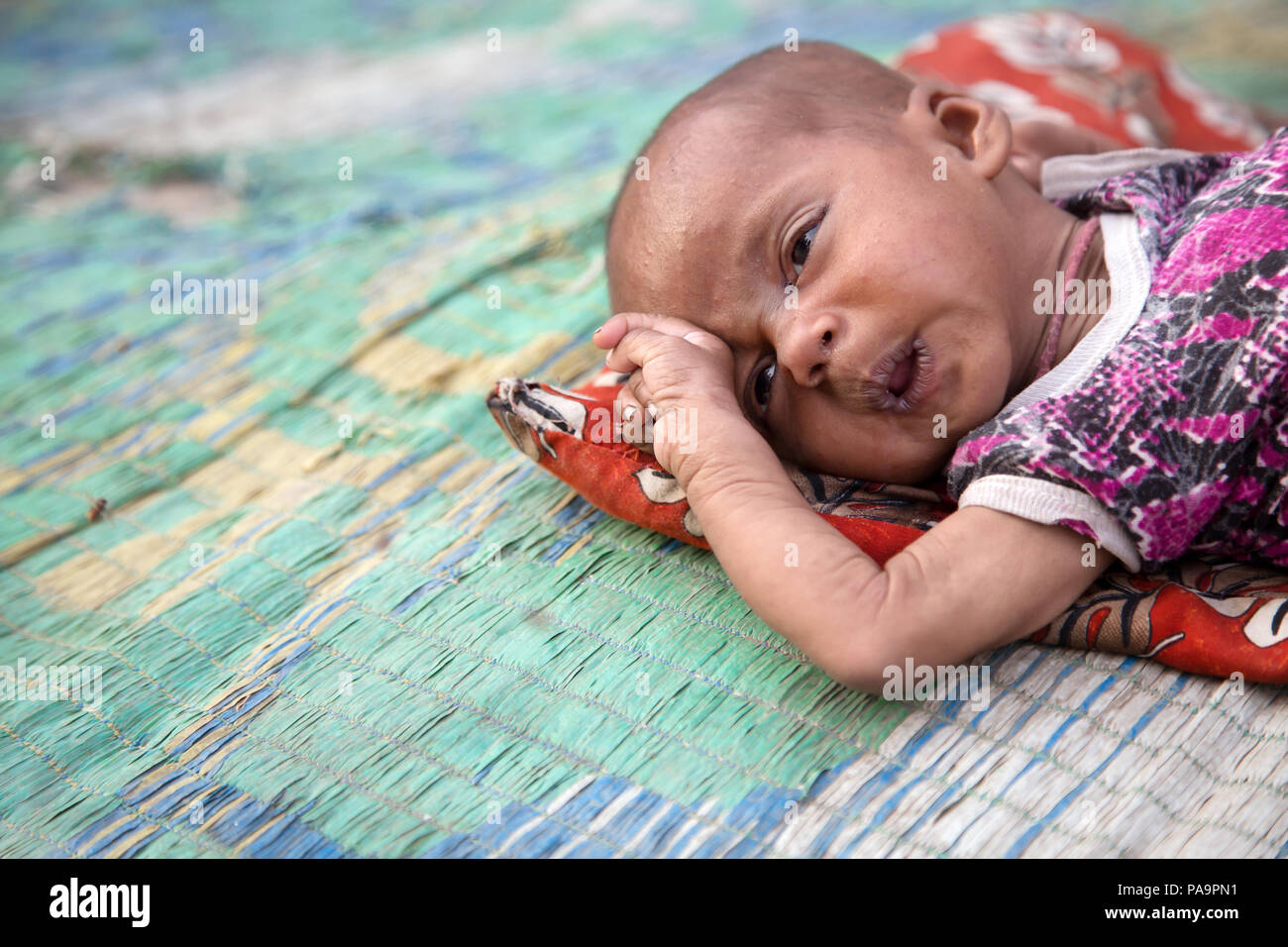 Disabled child at Chingari Rehabilitation Centre, Bhopal, India Stock Photo