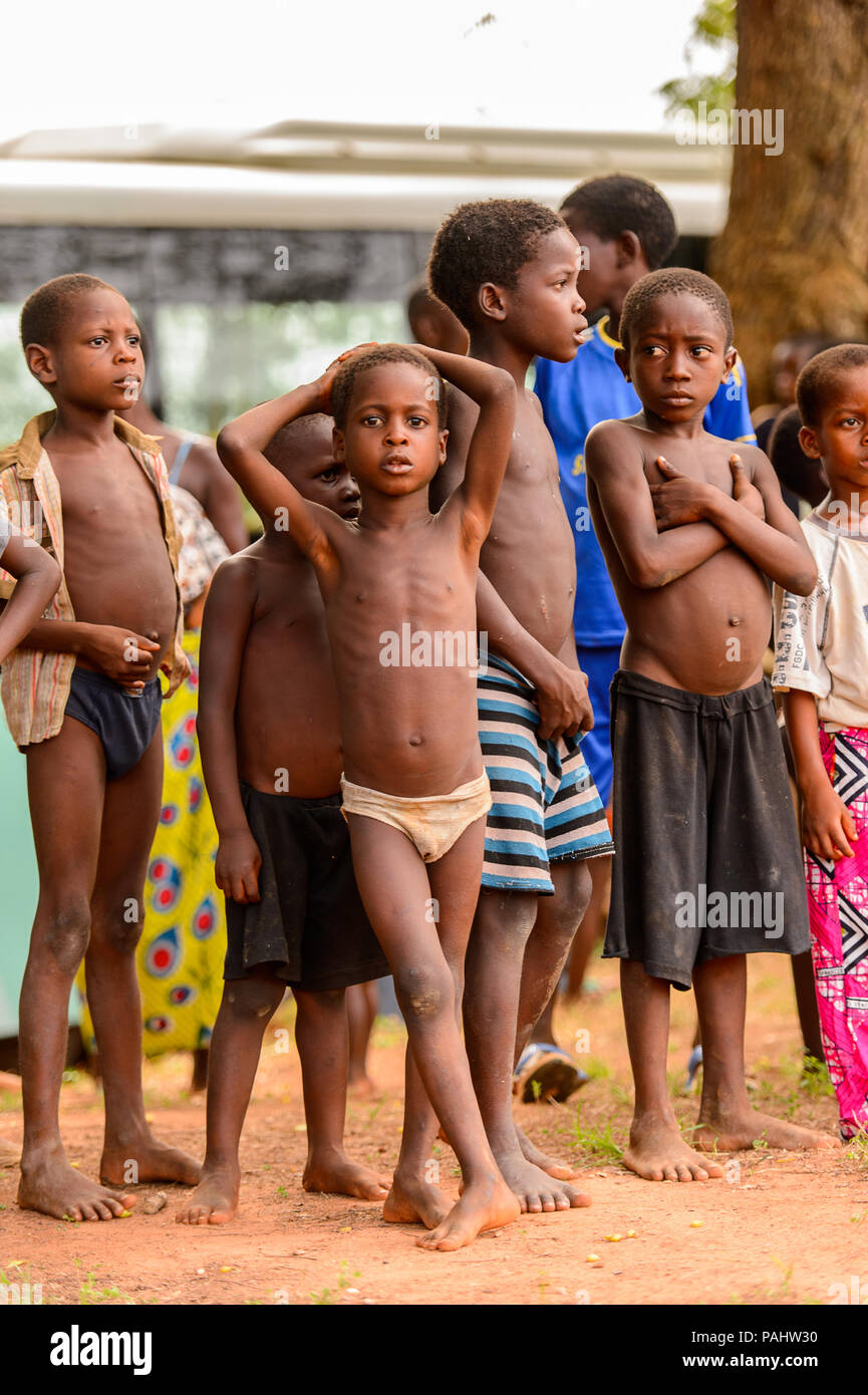 KARA, TOGO - MAR 9, 2013: Unidentified Togolese boy in yellow underpants  stays among the crowd. Children in Togo suffer of poverty due to the  unstable Stock Photo - Alamy