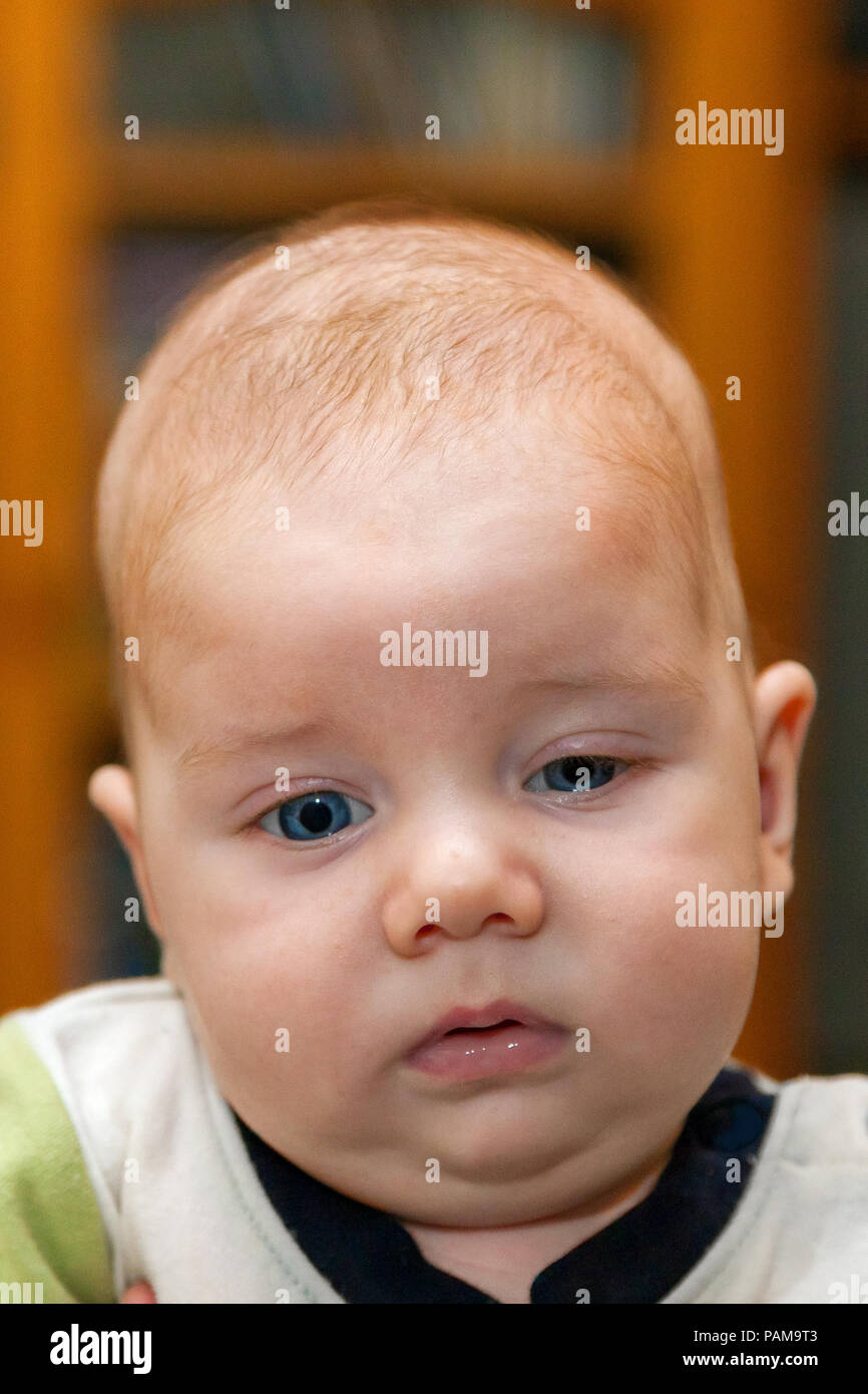 Ptosis hi-res stock photography and images - Alamy