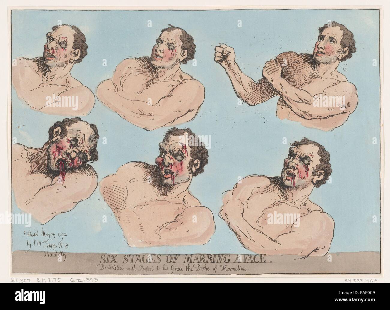 Six Stages of Marring a Face. Artist and publisher: Thomas Rowlandson (British, London 1757-1827 London). Dimensions: Sheet: 10 3/16 × 14 3/16 in. (25.8 × 36.1 cm). Date: May 29, 1792. Museum: Metropolitan Museum of Art, New York, USA. Stock Photo