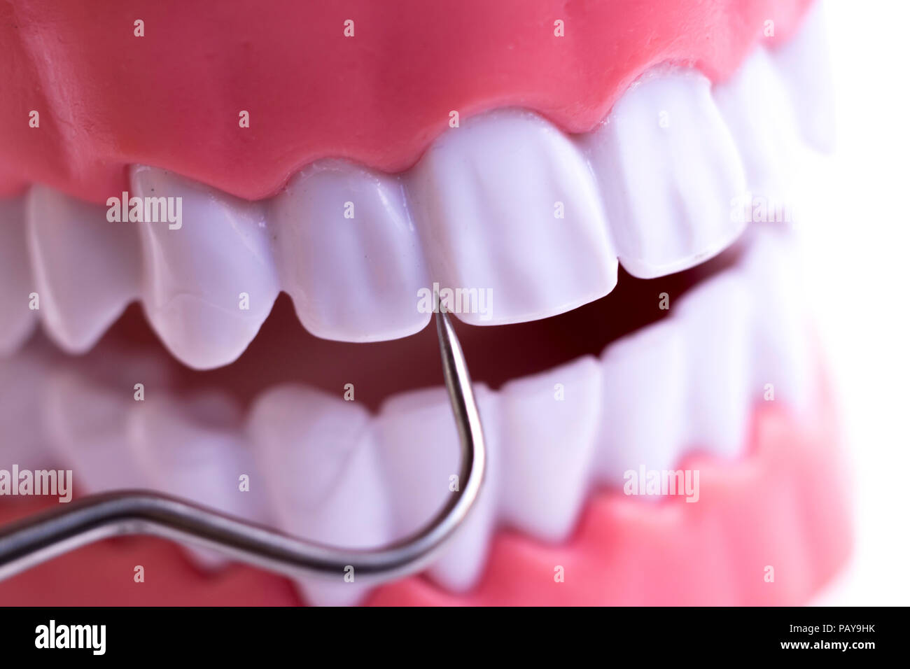 Dentist cleaning teeth with titanium metal tooth pick instrument to