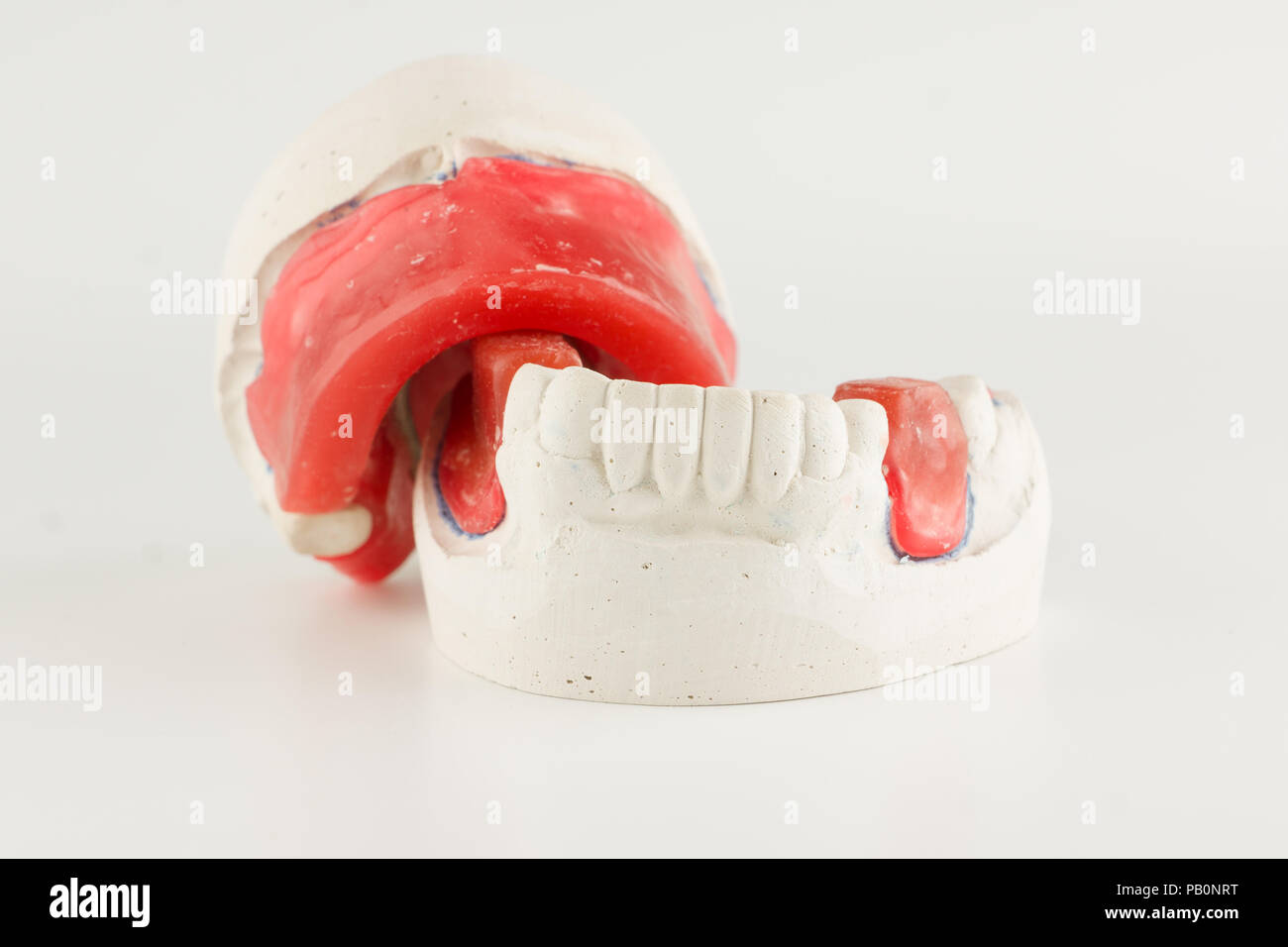 wax rollers on the tooth model for determining jaw closure Stock Photo