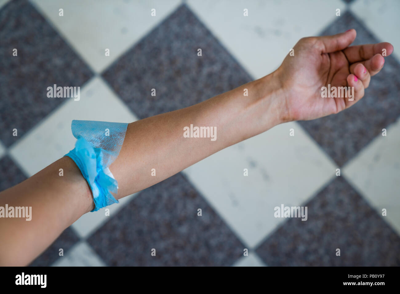 Blue gauze bandage on female arm after a blood donation Stock Photo Alamy