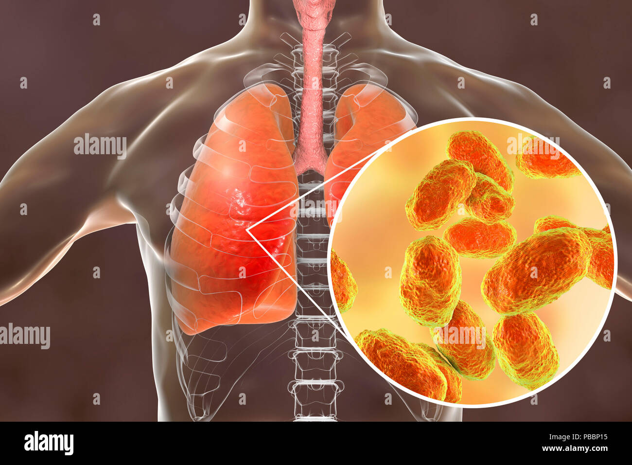 Haemophilus influenzae hi-res stock photography and images - Alamy