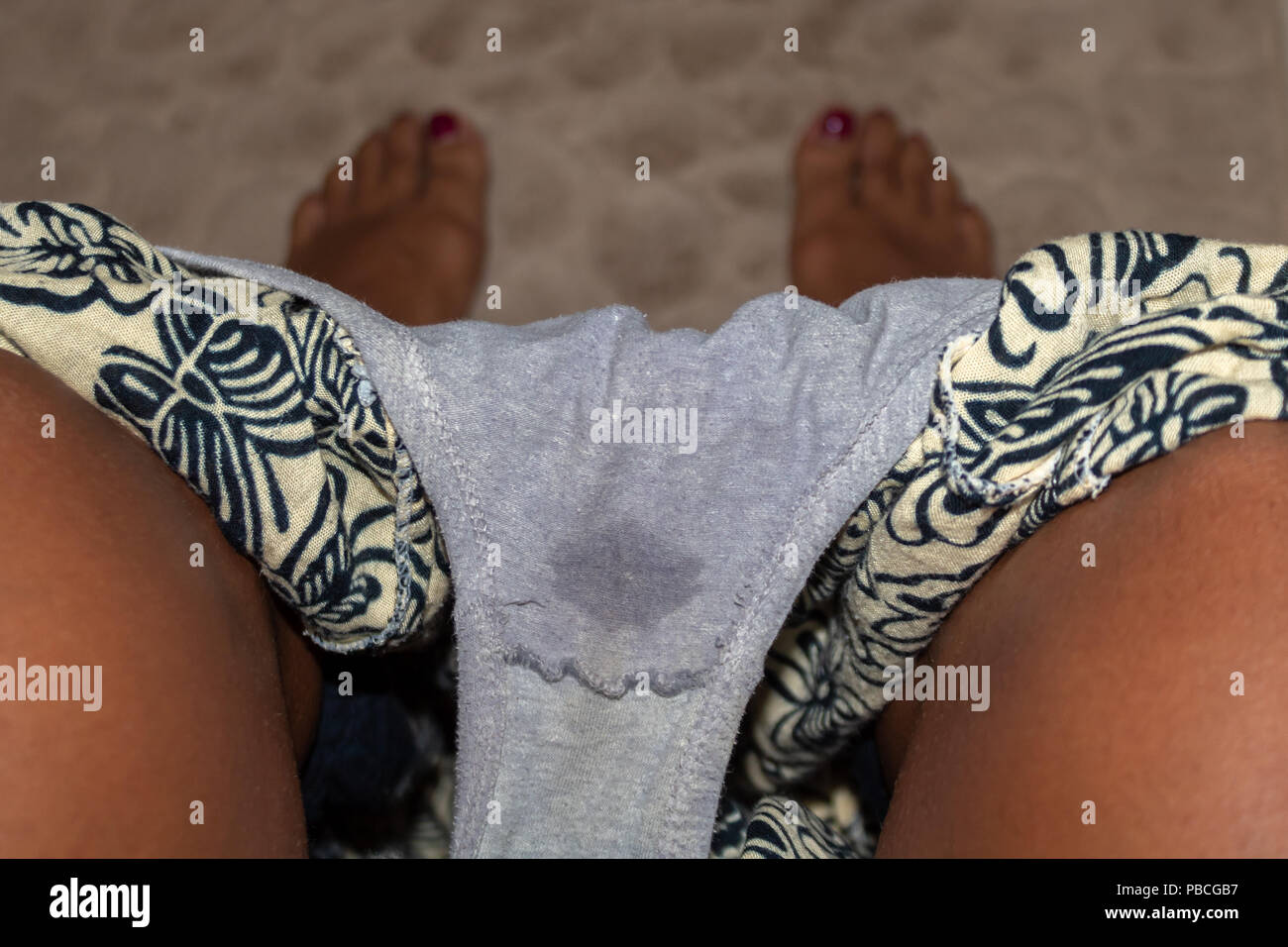 Female incontinence is a silent problem. Most women start having