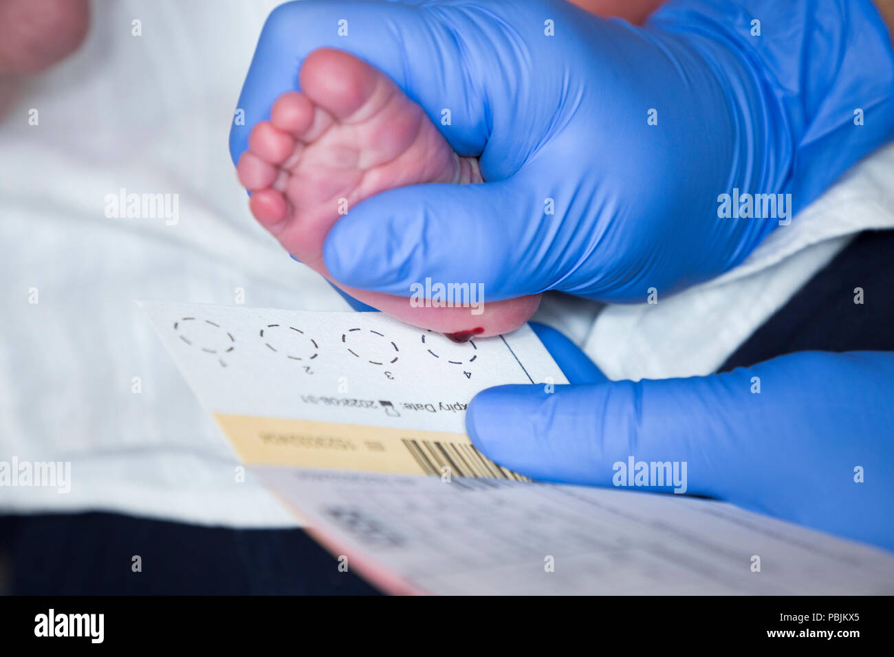 newborn-new-born-baby-undergoes-neonatal-heel-prick-screening-guthrie-test-where-blood-drops