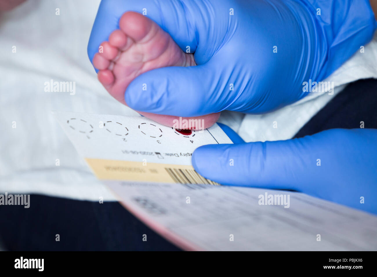 Newborn / new born baby undergoes neonatal heel prick screening ...