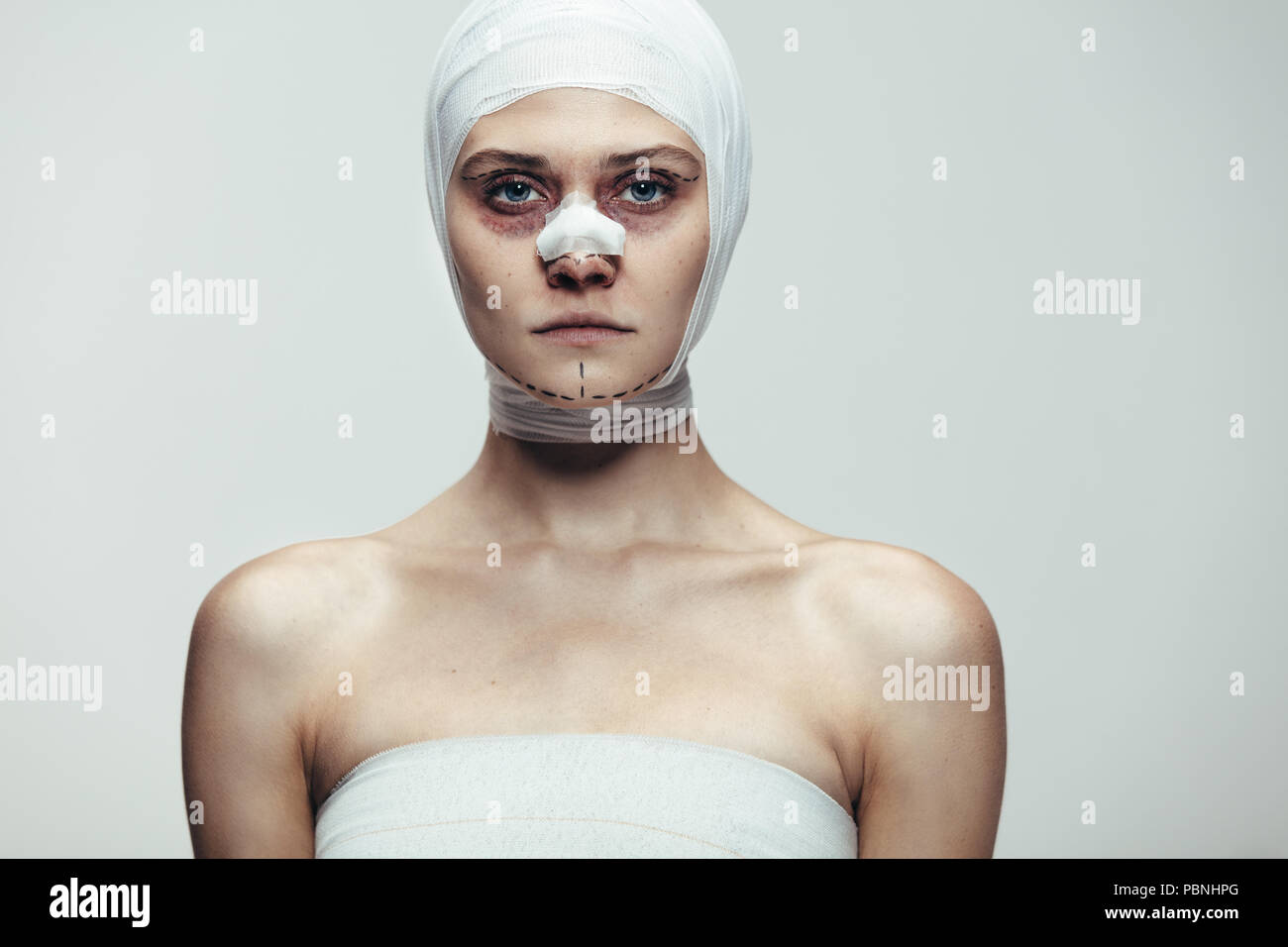 Portrait of woman wrapped in bandages after face lift cosmetic surgery