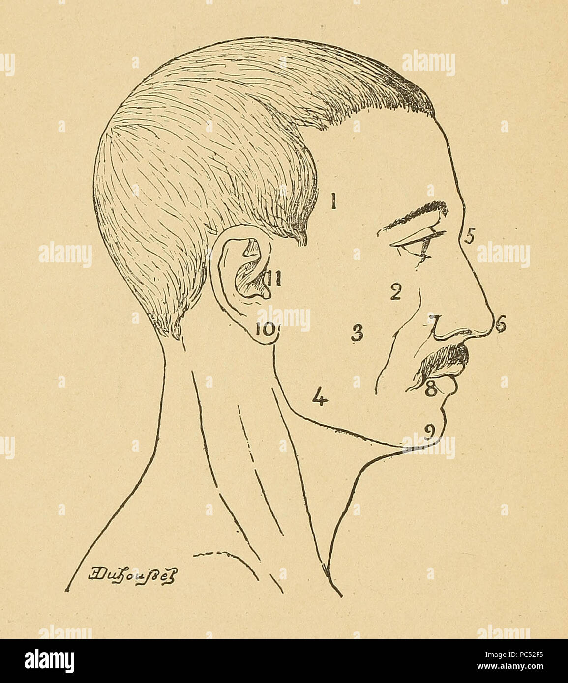 Bertillon System.drawing 14 Bertillon - Identification anthropométrique (1893) 356 Stock Photo ...