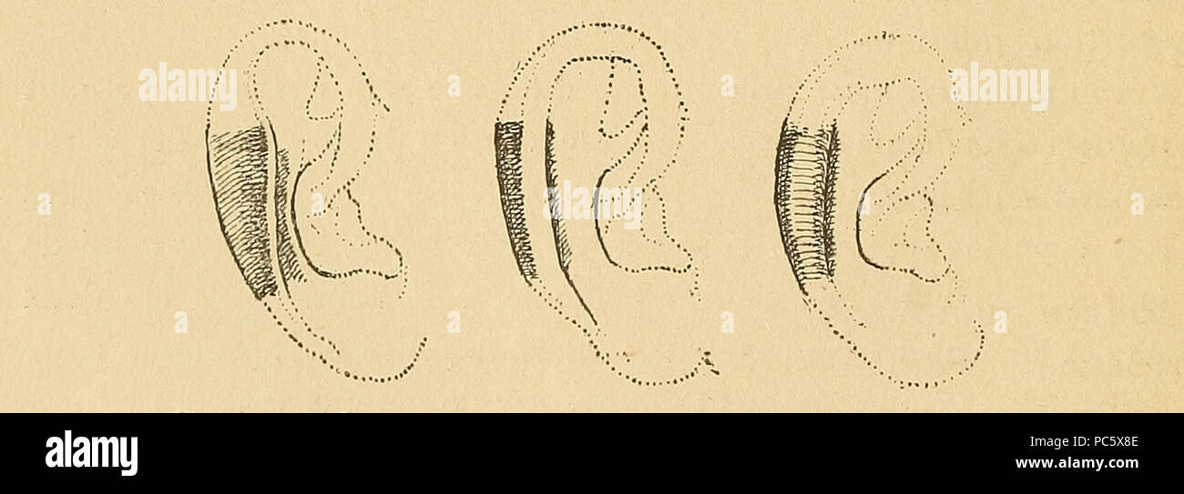 Bertillon System.drawing 13 Bertillon - Identification anthropométrique (1893) 060.3 Stock Photo ...